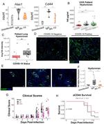 IL-13 Antibody in Neutralization (Neu)