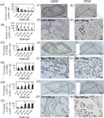 HIF-1 alpha Antibody in Immunohistochemistry (IHC)