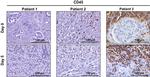 CD45 Antibody in Immunohistochemistry (IHC)