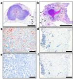 TGM2 Antibody in Immunohistochemistry (IHC)