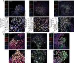 SOX2 Antibody in Immunohistochemistry (IHC)