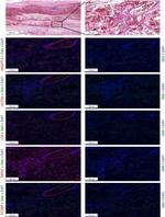 ANGPTL4 Antibody in Immunohistochemistry (IHC)