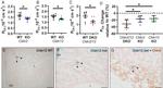 Claudin 2 Antibody in Immunohistochemistry, Immunohistochemistry (Frozen) (IHC, IHC (F))