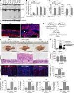 Myeloperoxidase Antibody in Immunohistochemistry (IHC)