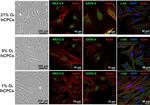 c-Kit Antibody in Immunocytochemistry (ICC/IF)