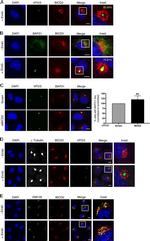 BAP31 Antibody in Immunocytochemistry (ICC/IF)