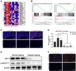 AKT3 Antibody in Western Blot, Immunohistochemistry (WB, IHC)