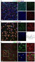 Parvalbumin Antibody in Immunohistochemistry (IHC)