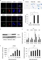 VE-cadherin Antibody in Immunohistochemistry (IHC)