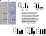 N-cadherin Antibody in Immunohistochemistry (IHC)