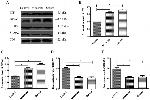 S100A7 Antibody in Western Blot (WB)