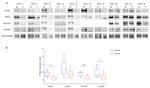 GluR4 Antibody in Western Blot (WB)