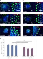 Paxillin Antibody in Immunocytochemistry (ICC/IF)