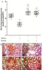 Bcl-2 Antibody in Immunohistochemistry (IHC)