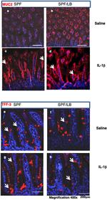 TFF3 Antibody in Immunohistochemistry (IHC)