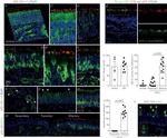 ACE2 Antibody in Immunohistochemistry (IHC)