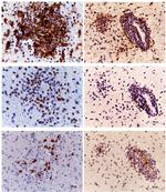 CD20 Antibody in Immunohistochemistry (IHC)