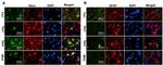 FIS1 Antibody in Immunohistochemistry (IHC)