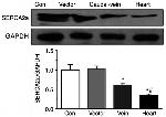 SERCA2 ATPase Antibody in Western Blot (WB)