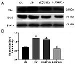 Bcl-2 Antibody in Western Blot (WB)