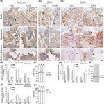 beta Catenin Antibody in Immunohistochemistry (IHC)