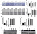 CXCR4 Antibody in Western Blot (WB)