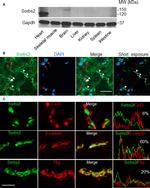 beta Catenin Antibody in Immunohistochemistry (IHC)