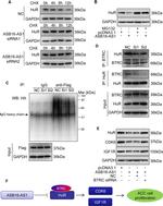 BTRC Antibody in Western Blot, Immunoprecipitation (WB, IP)