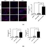 CD31 Antibody in Immunohistochemistry (IHC)