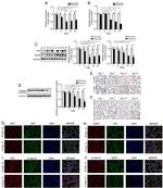 SFTPC Antibody in Immunohistochemistry (IHC)