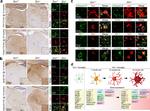 ADAM33 Antibody in Immunohistochemistry (IHC)