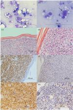 CD20 Antibody in Immunohistochemistry (IHC)