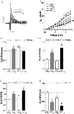 Calsequestrin Antibody in Western Blot (WB)