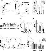 Calsequestrin Antibody in Western Blot (WB)