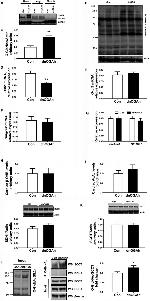 O-linked N-acetylglucosamine (O-GlcNAc) Antibody in Western Blot, Immunoprecipitation (WB, IP)