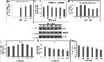 VGLUT1 Antibody in Western Blot (WB)