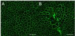 ZO-1 Antibody in Immunohistochemistry (IHC)