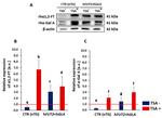 alpha Galactosidase Antibody in Western Blot (WB)