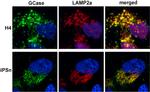 LAMP-2A Antibody in Immunocytochemistry (ICC/IF)