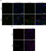 ZO-1 Antibody in Immunohistochemistry (IHC)