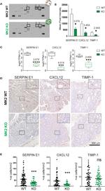 PAI1 Antibody in Immunohistochemistry (IHC)