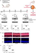 Tau Antibody in Western Blot (WB)