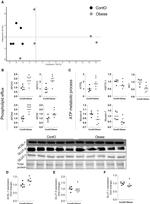 ACSL1 Antibody in Western Blot (WB)