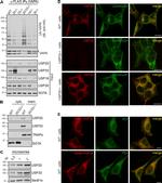 PDI Antibody in Immunocytochemistry (ICC/IF)