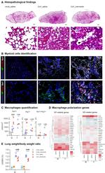 Arginase 1 Antibody in Immunohistochemistry (IHC)