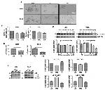 beta Catenin Antibody in Western Blot (WB)