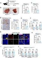 CCR2 Antibody in Immunohistochemistry (Paraffin) (IHC (P))