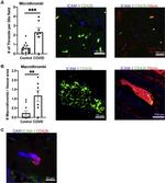 CD42b Antibody in Immunohistochemistry (IHC)