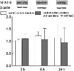 NFAT5 Antibody in Western Blot (WB)