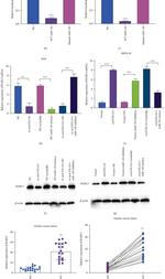 RABL3 Antibody in Western Blot (WB)